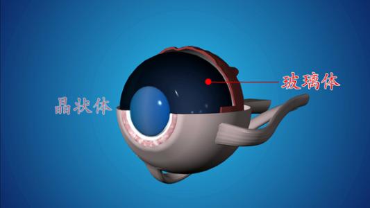 外傷性白內障