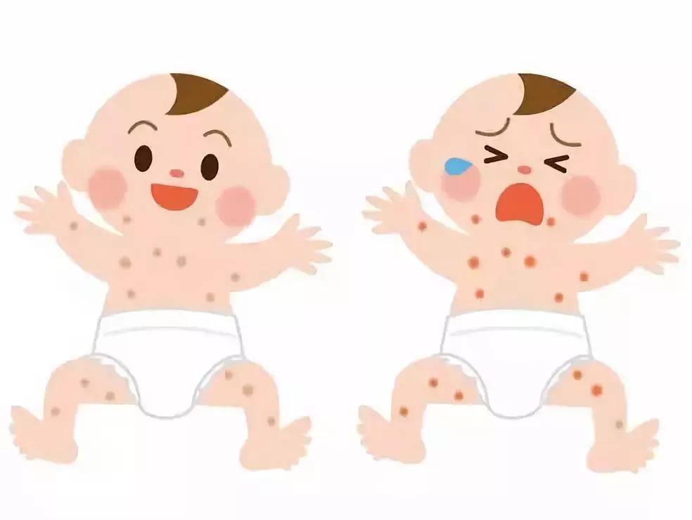 小兒類風(fēng)濕病