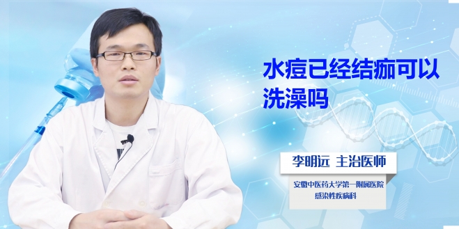 水痘已經結痂可以洗澡嗎？